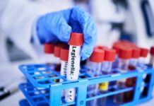 A gloved hand holding a test tube labeled 'Legionella' among other samples