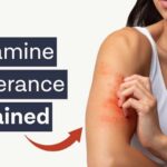 The surprising truth about histamine intolerance | Dr. Will