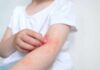Child's arm showing skin irritation and redness