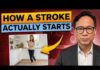 Silent Stroke Signs: Are You Ignoring Them? What a Stroke Looks Like the Day Before It Hits — Know This to Protect Yourself