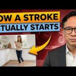 What a Stroke Looks Like the Day Before It Hits — Know This to Protect Yourself