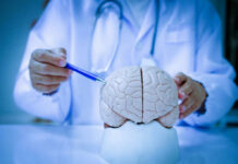 Brain Shrink Warning: When It Starts A doctor pointing at a brain model with a pen