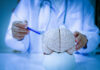 When a Headache Becomes Dangerous A doctor pointing at a brain model with a pen