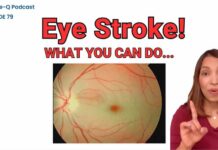 Sudden Vision Loss? It Could Be an Eye Stroke (BE FAST)