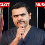 Deadly Clot Or Just Cramp? How to Tell the Difference Don't Ignore These 10 LEG PAIN Signs That Could Save Your Life