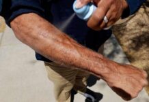 Sunscreen Myth Exposed: Most Are Using It Wrong Mayo Clinic Minute - What type of sunscreen should you use?