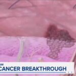New cancer vaccine shows promise in extending life span in late-stage trial