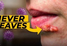 Herpes: Why It HIDES in Your Nerves Forever