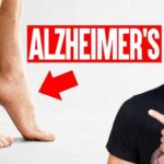 5 Physical Signs Linked to Alzheimer's & Dementia