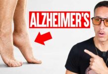 Silent Dementia Clues Below The Neck 5 Physical Signs Linked to Alzheimer's & Dementia