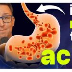 The Acid Reflux Diet I Recommend to All My Patients