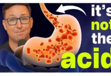 The Acid Reflux Diet I Recommend to All My Patients
