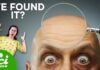 Reversing Men Baldness? Read The Fine Print Can Baldness Be Reversed?